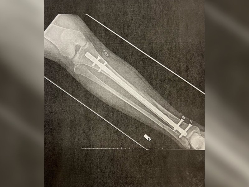 Being broke, broken and brazen